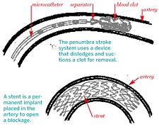 vascular system illustratoin